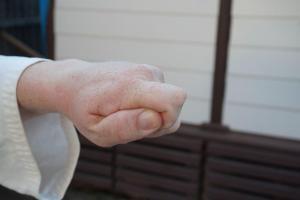 Ippon One Knuckle Fist - pictures of Karate fists types