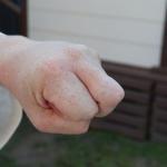Nakadaka Middle Knuckle Fist – pictures of Karate fists types