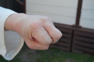 Nakadaka Middle Knuckle Fist - pictures of Karate fists types
